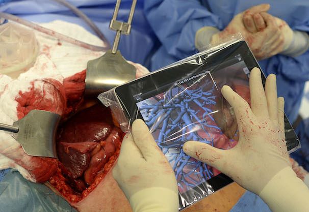 iPad в хирургии в медицине