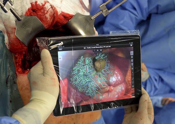 iPad в хирургии в медицине