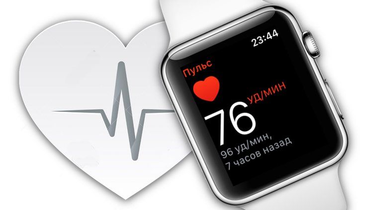 Как контролировать сердечную аритмию при помощи Apple Watch