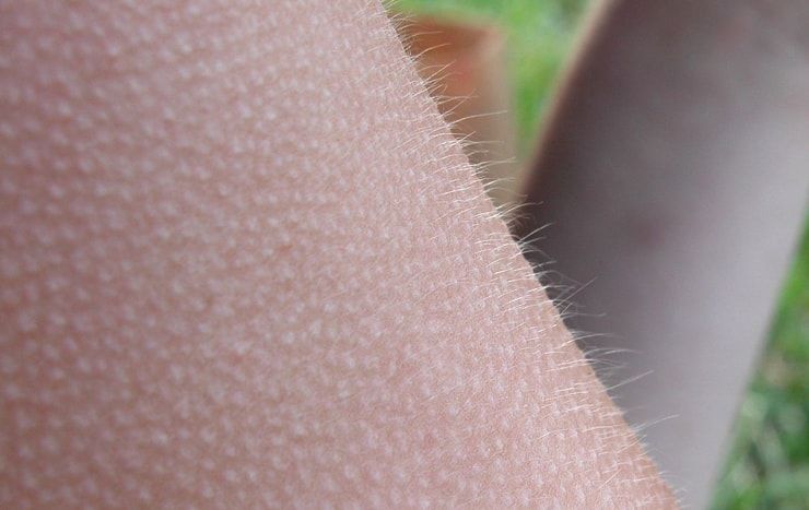 Why does goose bumps appear?