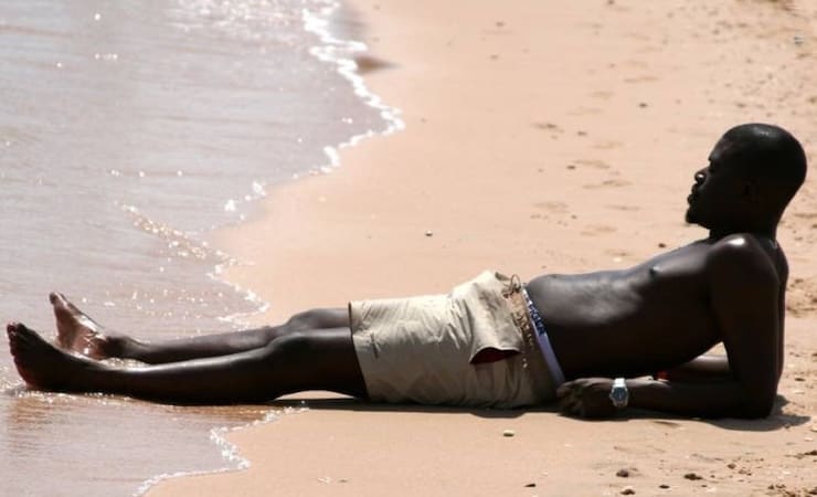 Can a dark-skinned person get sunburn?