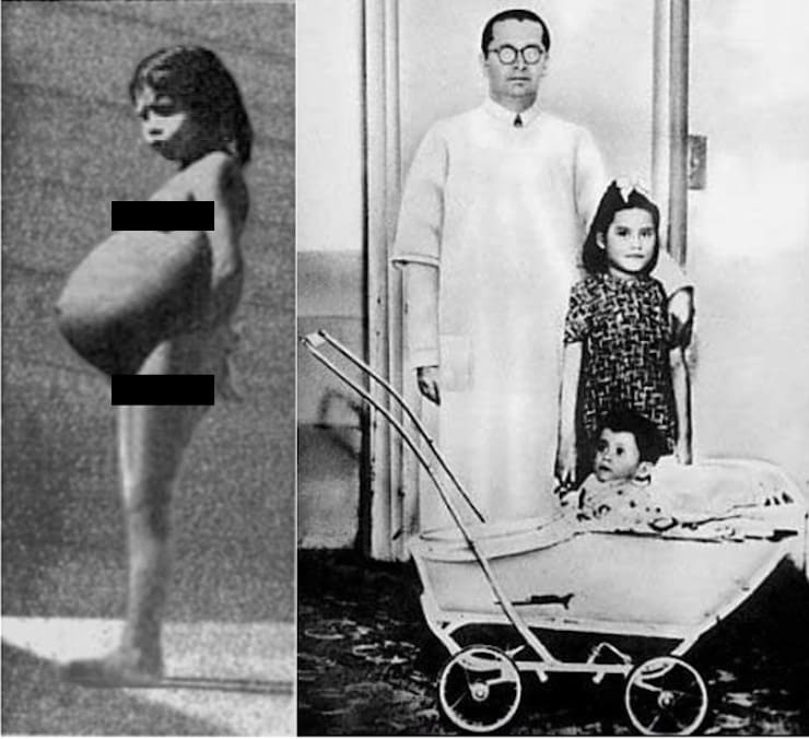 Lina Medina est la plus jeune mère de l'histoire de la médecine à accoucher à l'âge de 5 ans.