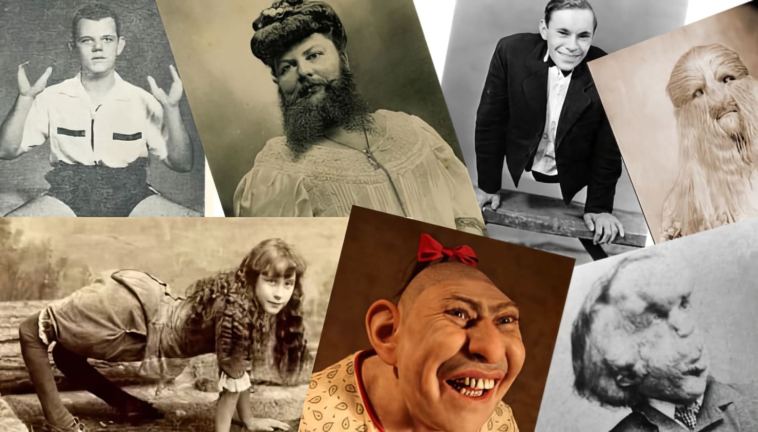 Знаменитые артисты «цирка уродцев»: люди с удивительными анатомическими отклонениями